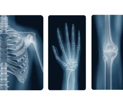 Physics Form 4 Notes Chapter Eight X Rays